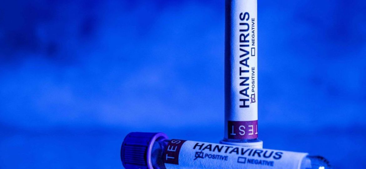 Evacuan-en-Tenerife-a-pasajeros-del-crucero-MV-Hondius-tras-brote-de-hantavirus-una-pasajera-francesa-esta-en-cuidados-intensivos